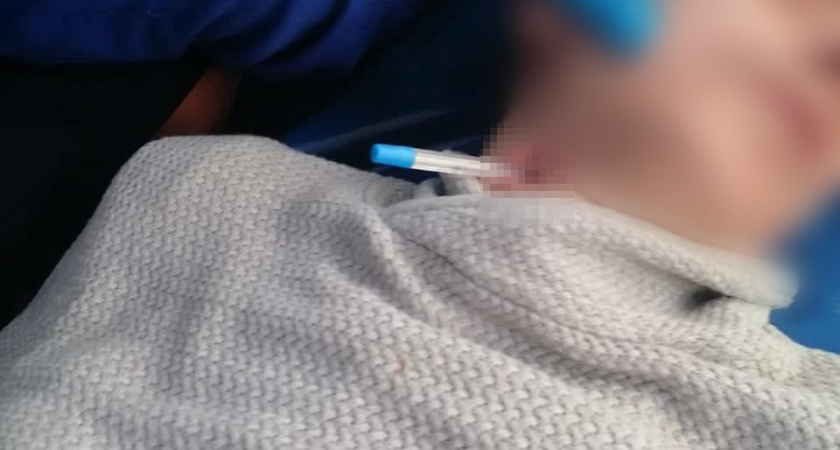 Хирурги Чувашии спасли мужчину с шариковой ручкой в шее