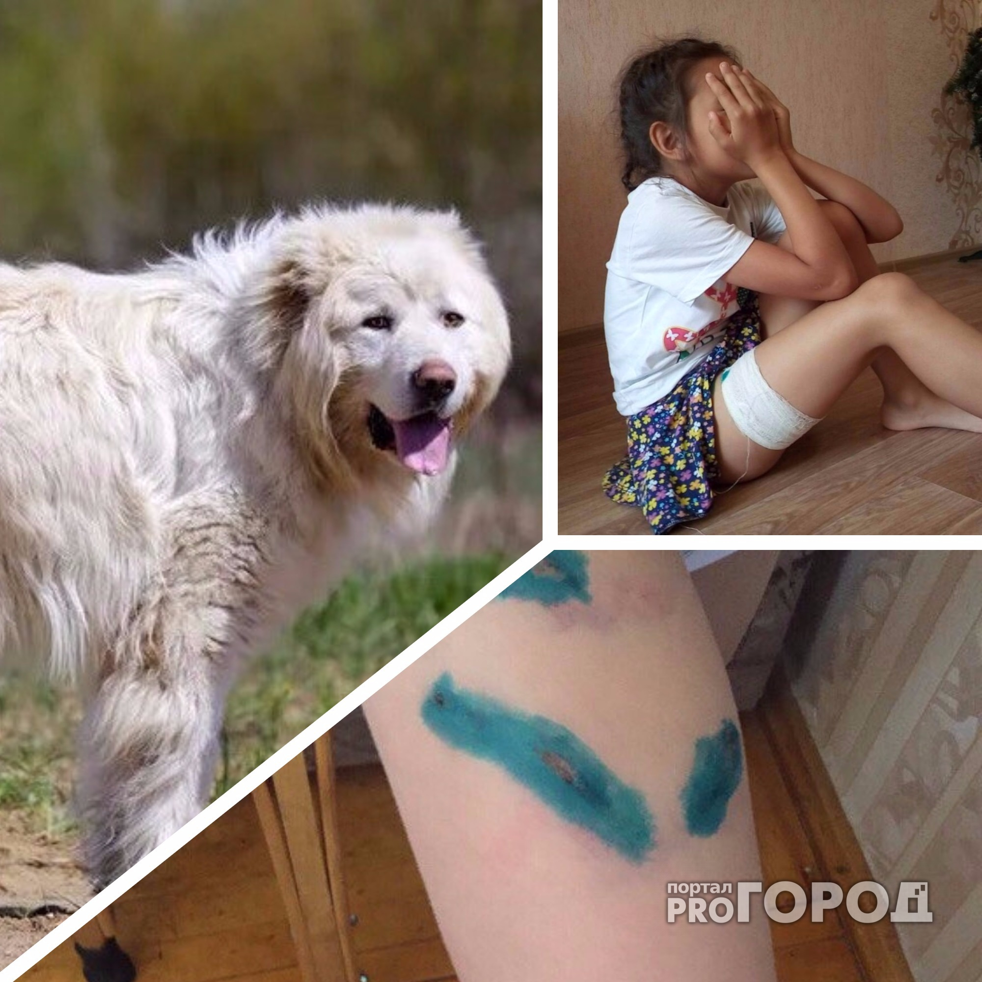 В Новочебоксарске цепная собака покусала 8-летнюю девочкy